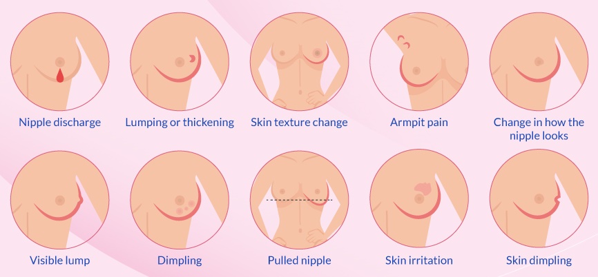 Breast-Cancer-Signs-and-Symptoms.jpg